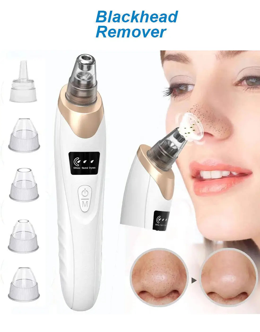 5-In-1 USB Rechargeable Blackhead Remover & Derma Suction Facial Cleansing Device