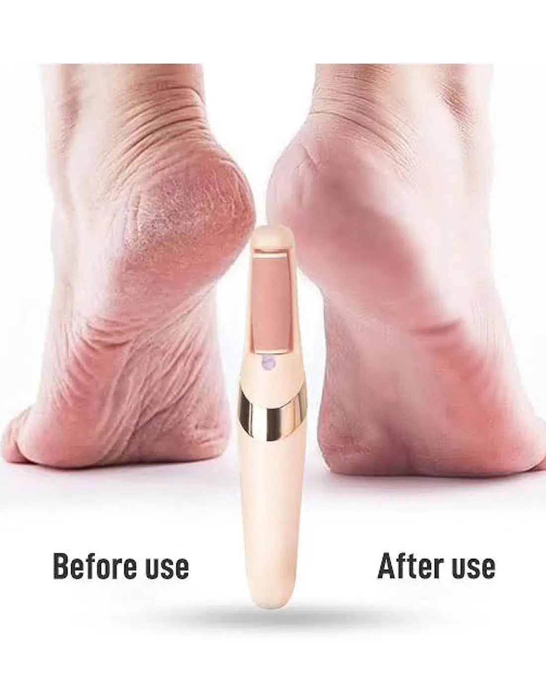WEIMEI Rechargeable Electric Foot File Callus Remover for Wet & Dry Pedicure